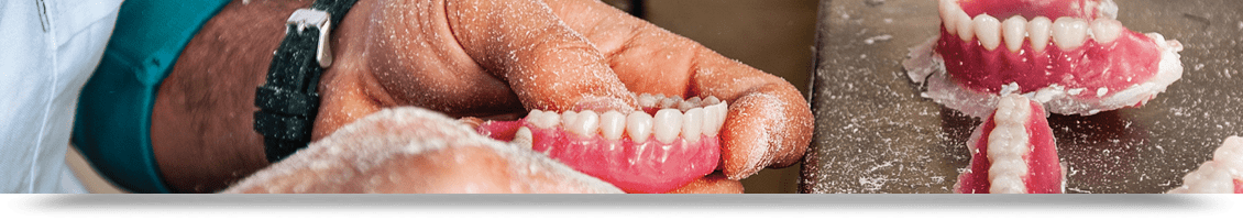 removable restorations page header