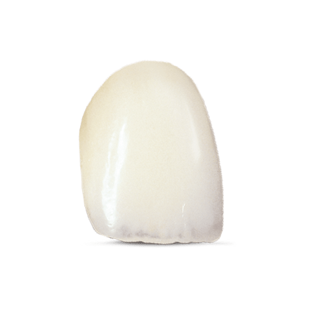 IPS Empress<sup>®</sup> Esthetic